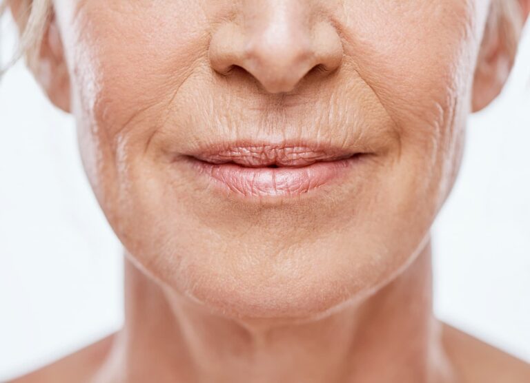 woman's face with wrinkles