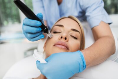 The Many Uses of Microneedling