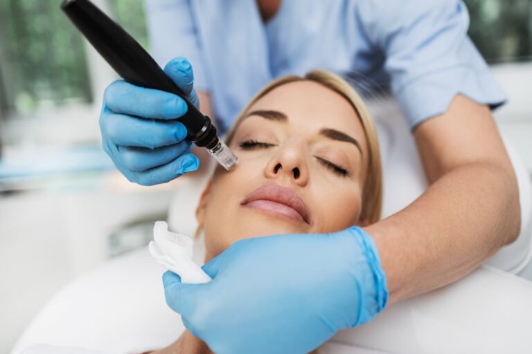 The Many Uses of Microneedling