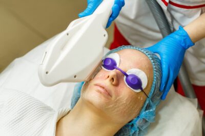 The Best Nonsurgical Treatments for Sun Damage